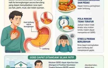 Apa Saja Pemicu dan Bahaya GERD? Ini Penjelasan dari RSUD Majalengka ‎ 