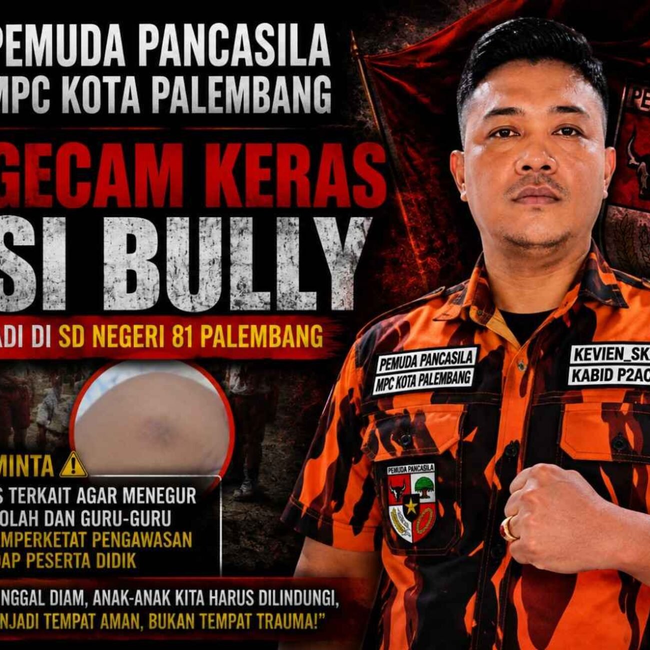 Dugaan Bullying SDN 81 Palembang Disorot, Pemuda Pancasila Desak Sekolah Bertindak